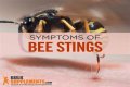 Can you get Covid from bee sting?